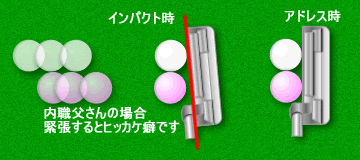 パターのヒッカケ/プッシュアウト